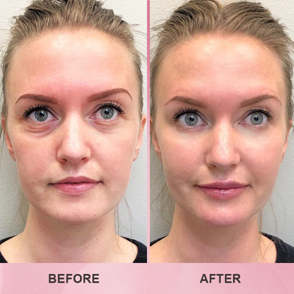 LIMETOW™ Multi Collagen Balm Stick