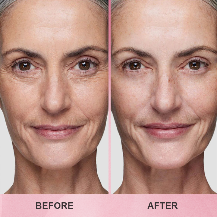 LIMETOW™ Multi Collagen Balm Stick