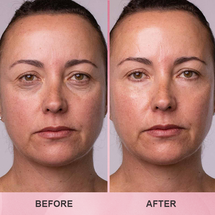 LIMETOW™ Multi Collagen Balm Stick