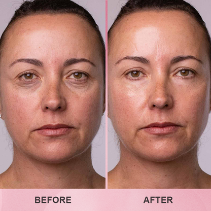 LIMETOW™ Multi Collagen Balm Stick