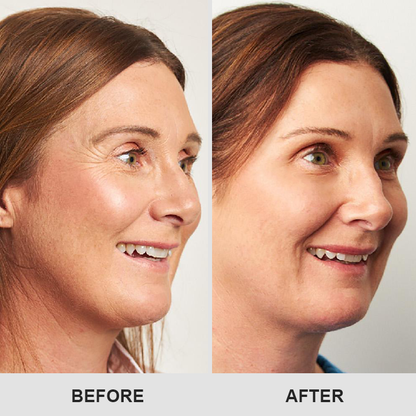 Retinol Eye Stick✅ for Reduces Fine Lines，Puffiness and Dark Circles🌟