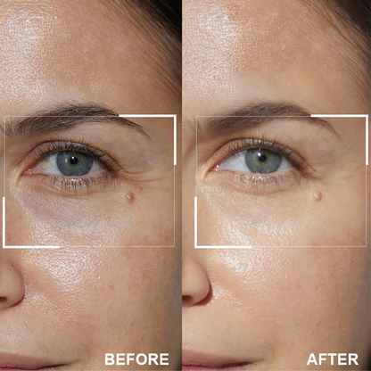 Retinol Eye Stick✅ for Reduces Fine Lines，Puffiness and Dark Circles🌟