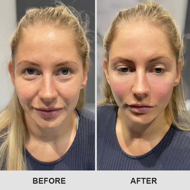 Retinol Eye Stick✅ for Reduces Fine Lines，Puffiness and Dark Circles🌟