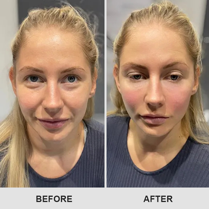 Retinol Eye Stick✅ for Reduces Fine Lines，Puffiness and Dark Circles🌟